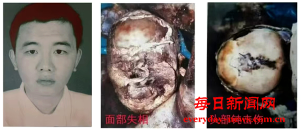 案123号连接111111111.png